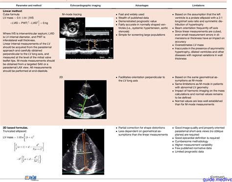 Recommendations for Cardiac Chamber Quantification by 